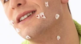 Remedies-for-Shaving-Nicks-and-Cuts-524.webp